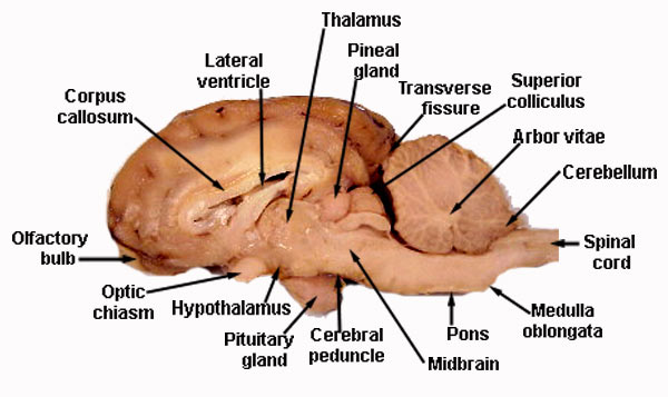 sagittal veiw sheep brain quiz